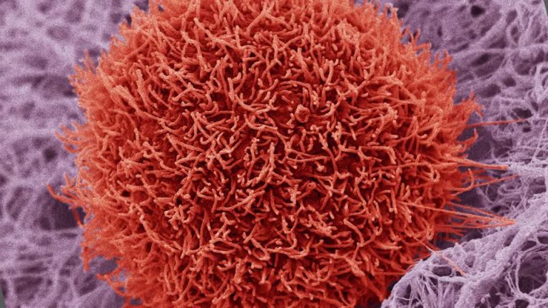 717725243-celula-cancerigena-proyeccion-nano-world-observacion-con-microscopio-electronico