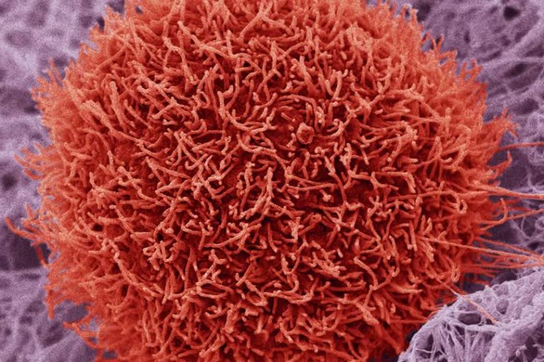717725243-celula-cancerigena-proyeccion-nano-world-observacion-con-microscopio-electronico