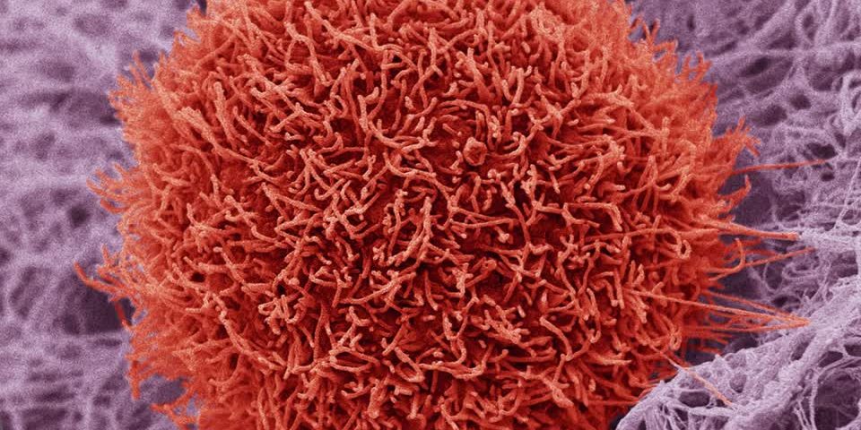 717725243-celula-cancerigena-proyeccion-nano-world-observacion-con-microscopio-electronico