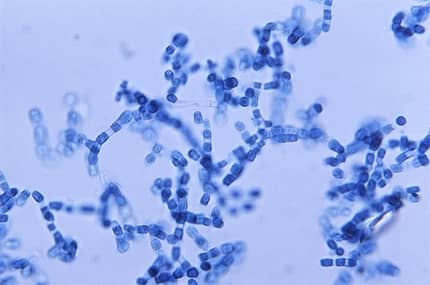 cocci-definition