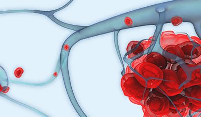 biopsia liquida genolife
células circulantes tumorales
CTCs