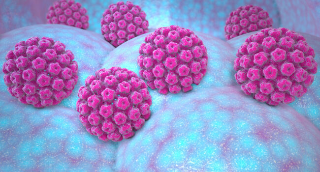 vph
VIRUS
INFECCION
SEXUAL
TRANSMISION
HOMBRE
MUJER