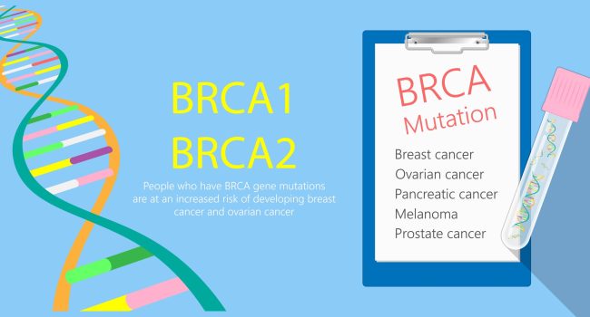 BRCA gene test for breast and ovarian cancer