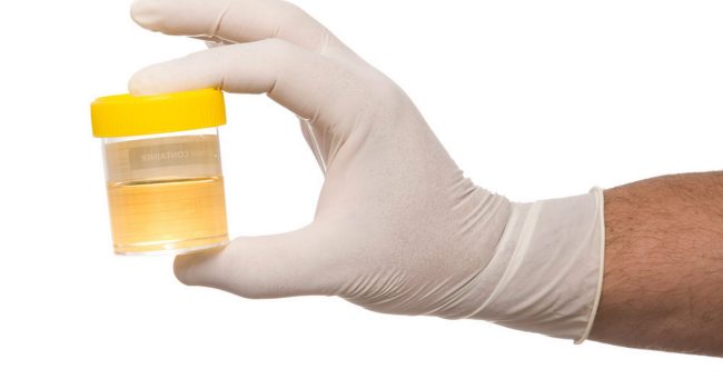 Urine-Test