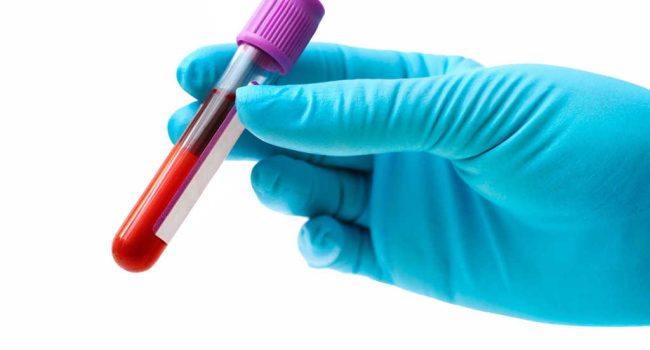 Crean-sangre-artificial-que-no-provoca-rechazo